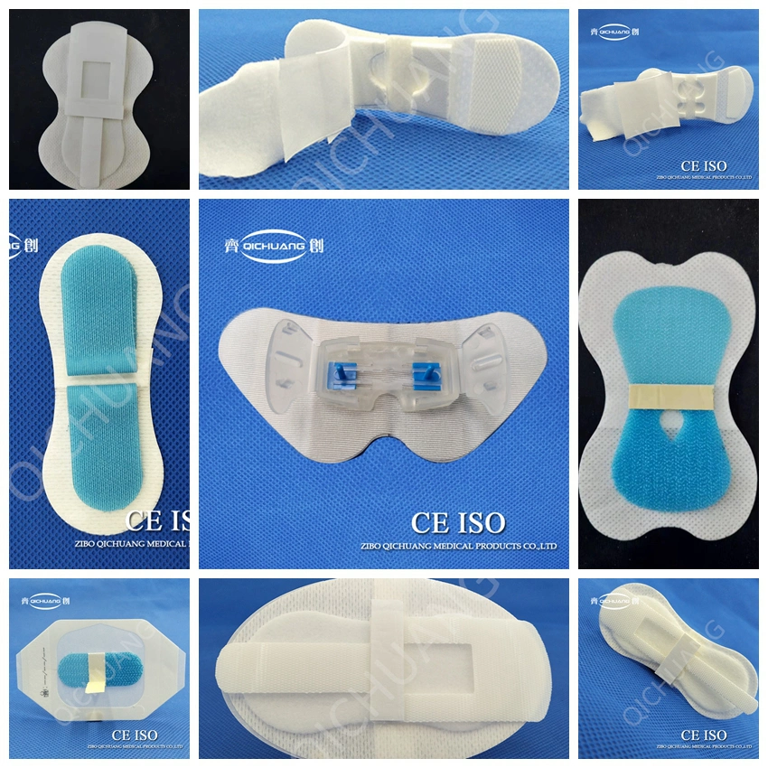 Body Surface Fixing Device-Nasal Feeding Tube Fixation Device IV Cannula Stabilization Devices